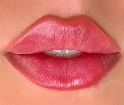 تزریق ژل لب نچرال و روسی